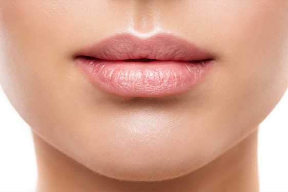 Lippen formen lassen – Hyaluron in die Lippen spritzen zur Vergrößerung von Oberlippe oder Unterlippe