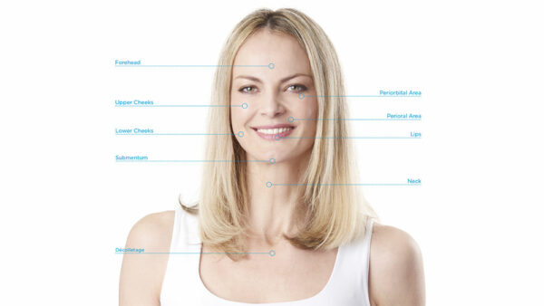 Radiofrequenz Gesicht – Frau mit verjüngter Haut durch Radiofrequenz Behandlung